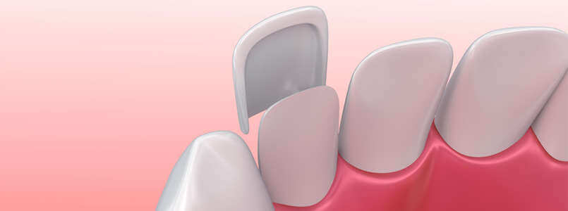 www.dentolo.de